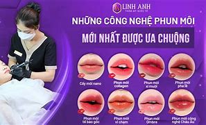 Công Nghệ Phun Môi Mới Nhất 2023